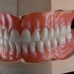 Акриловые зубные протезы: превосходное качество по низкой цене