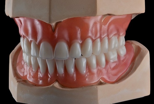 Акриловые зубные протезы: превосходное качество по низкой цене